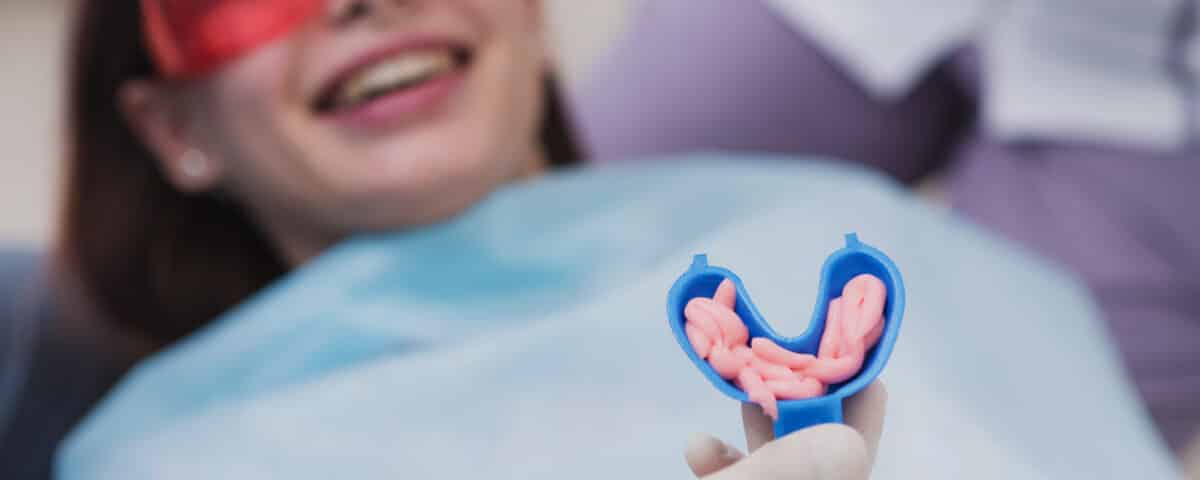 5-facts-about-adult-fluoride-treatments