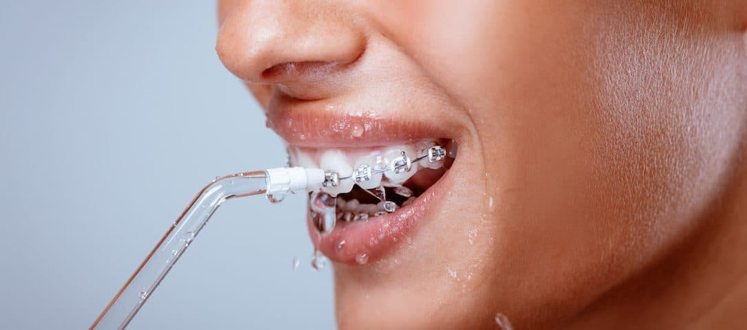 Water-Flossing-vs-Normal-Flossing-Which-to-Choose