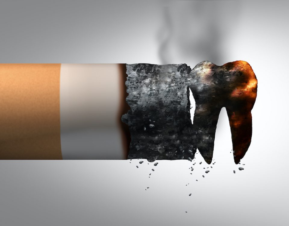 What-Smoking-Does-to-Your-Teeth