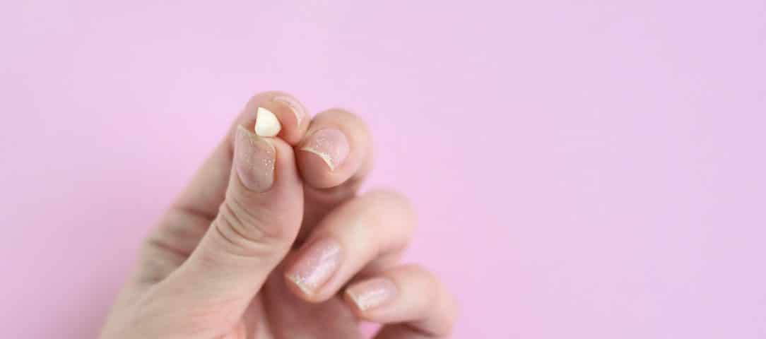 a-guide-to-dental-emergencies