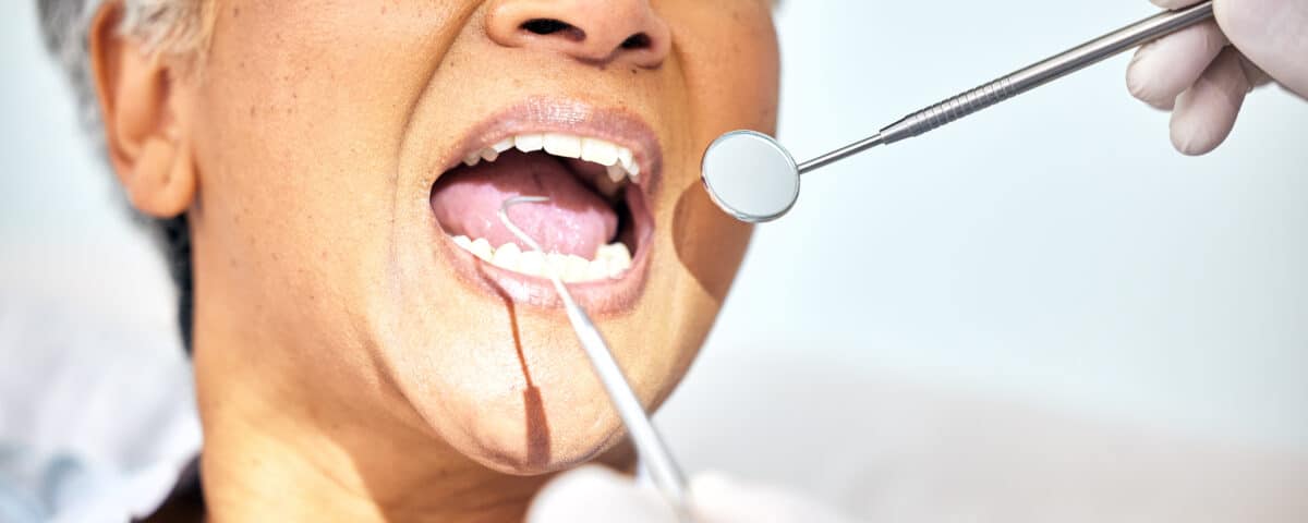 adult-tooth-loss-how-it-affects-your-smile
