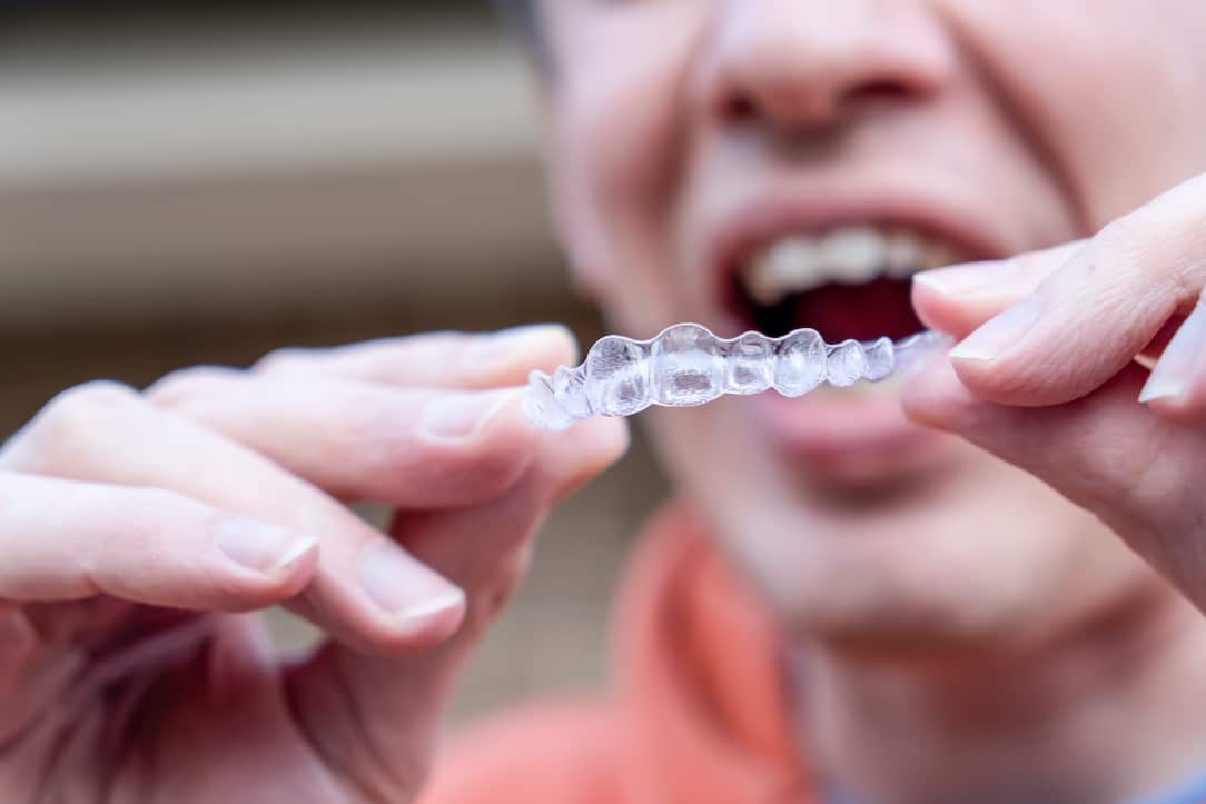 can-i-get-invisalign-if-im-an-adult