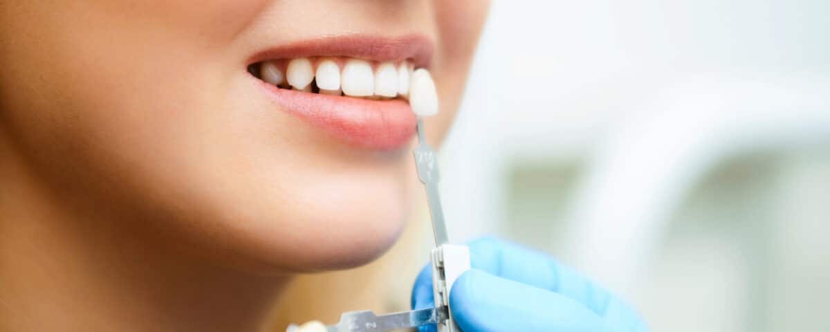 cosmetic-dentistry-in-eagle