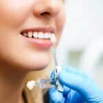 cosmetic-dentistry-in-eagle