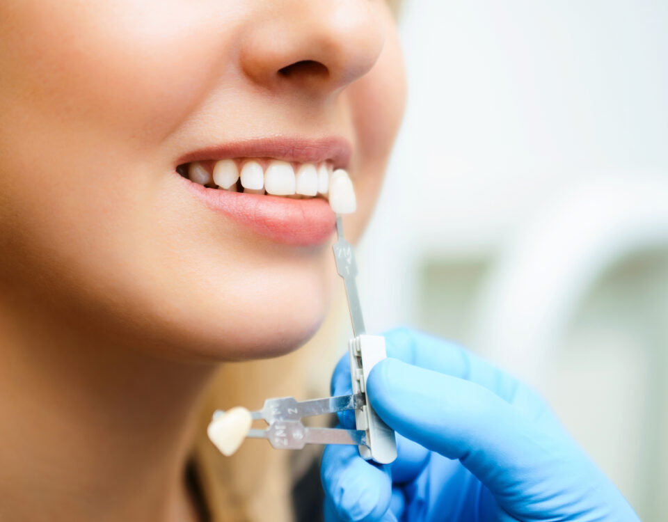 cosmetic-dentistry-in-eagle