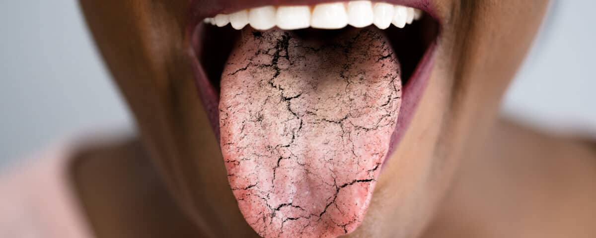fight-the-symptoms-of-dry-mouth-with-these-tips-from-premier-dentistry-of-eagle