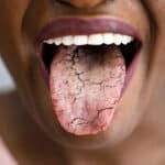fight-the-symptoms-of-dry-mouth-with-these-tips-from-premier-dentistry-of-eagle