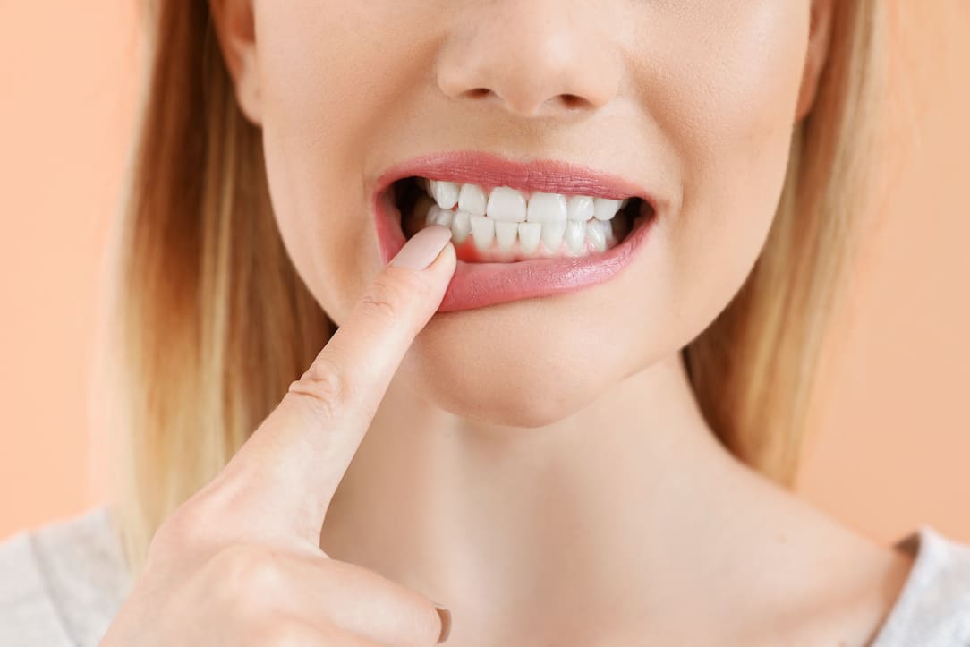 how-to-prevent-periodontitis