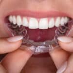 how-to-put-a-stop-to-teeth-grinding-at-night