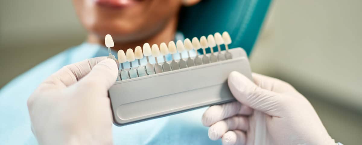 prolong-the-life-of-your-dental-veneers-with-these-helpful-tips