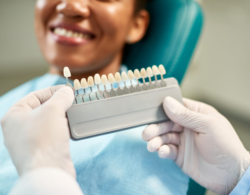 prolong-the-life-of-your-dental-veneers-with-these-helpful-tips