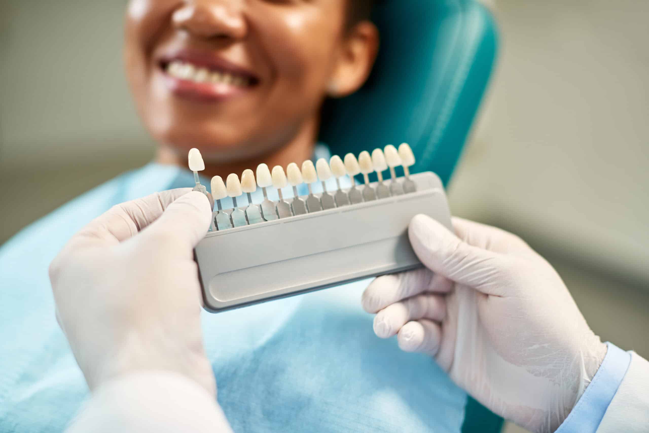 prolong-the-life-of-your-dental-veneers-with-these-helpful-tips