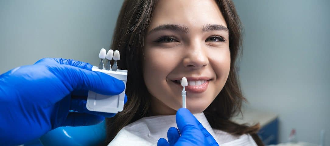 pros-and-cons-of-dental-veneers