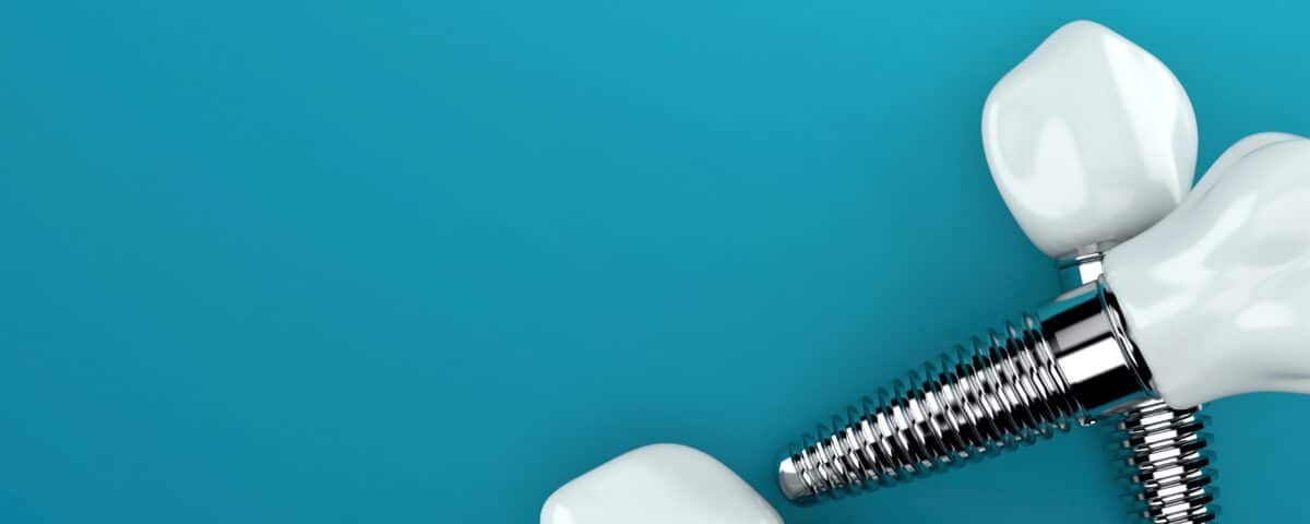 Regain Your Smile: 3 Reasons to Consider Dental Implants