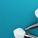 Regain Your Smile: 3 Reasons to Consider Dental Implants