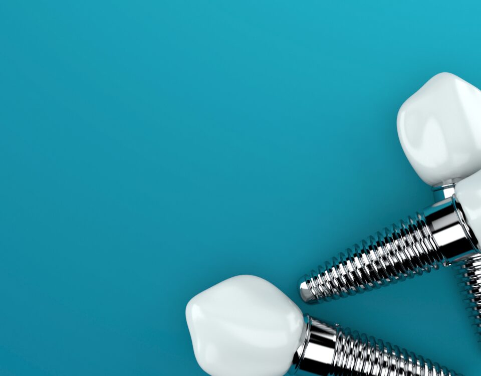 Regain Your Smile: 3 Reasons to Consider Dental Implants