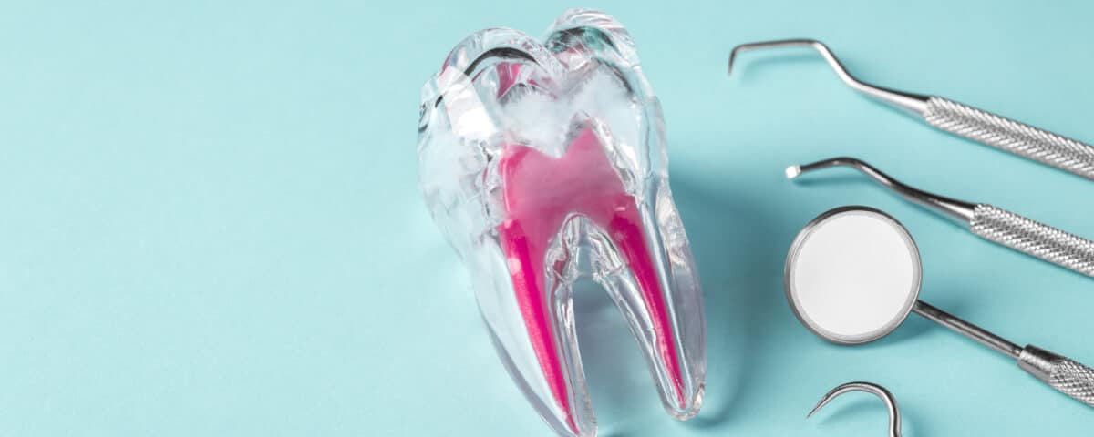 root-canal-relief-why-saving-your-natural-tooth-matters