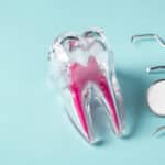 root-canal-relief-why-saving-your-natural-tooth-matters