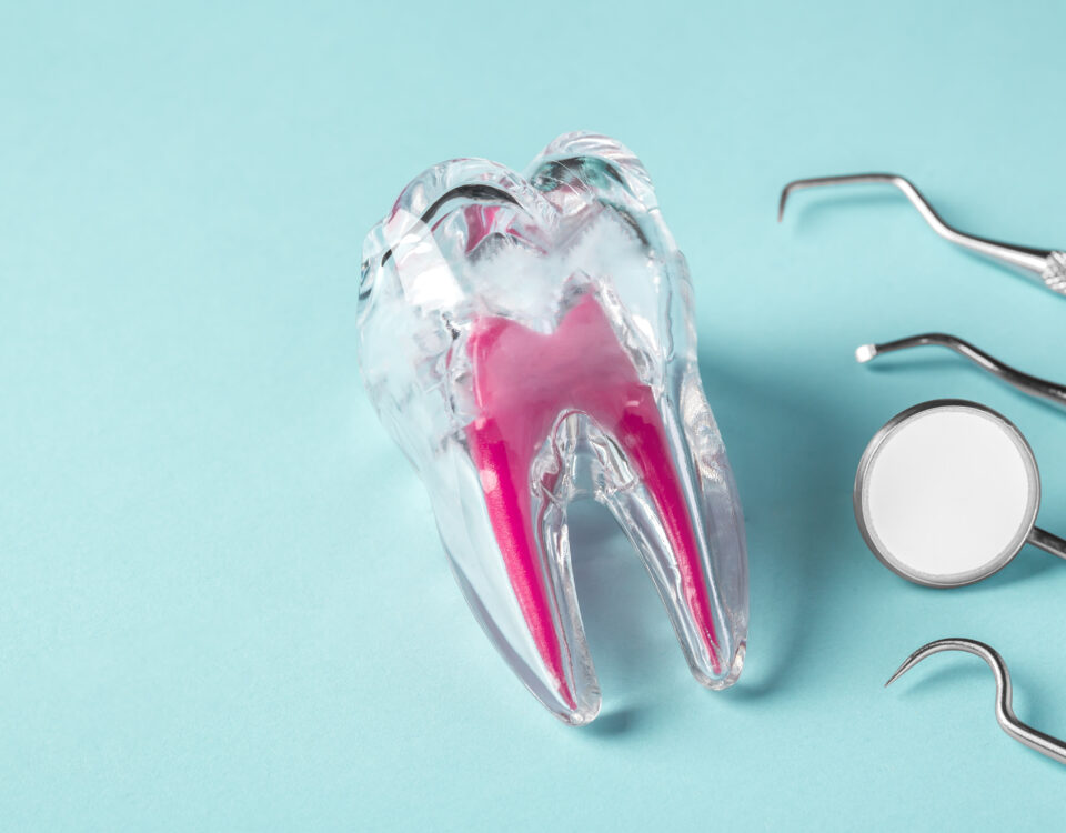 root-canal-relief-why-saving-your-natural-tooth-matters