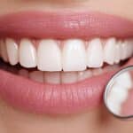 small-changes-big-smiles-everyday-choices-that-strengthen-your-teeth