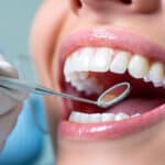 the-benefits-of-fluoride-for-adults