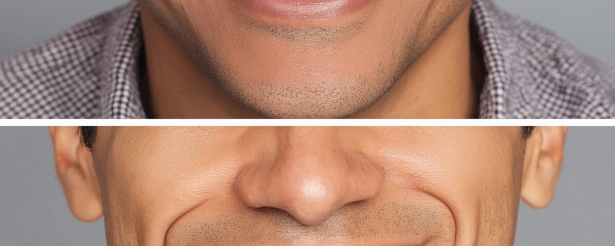 why-summer-is-the-perfect-time-for-cosmetic-dentistry-treatments